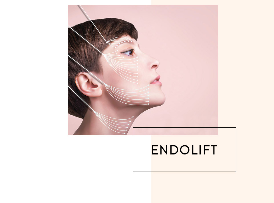 ENDOLIFT - technologie médicale esthétique