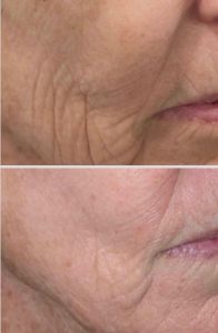 WhatsApp Image 2026-02-11 at 17.37.39