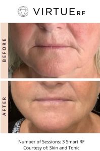 WhatsApp Image 2026-02-11 at 17.37.40 (3)