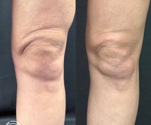 WhatsApp Image 2026-02-11 at 17.37.40