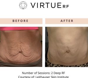 WhatsApp Image 2026-02-11 at 17.37.40 (8)