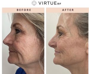 WhatsApp Image 2026-02-11 at 17.37.40 (9)