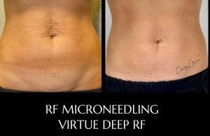 WhatsApp Image 2026-02-11 at 17.37.41 (1)