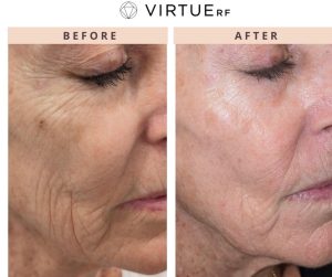 WhatsApp Image 2026-02-11 at 17.37.41 (2)