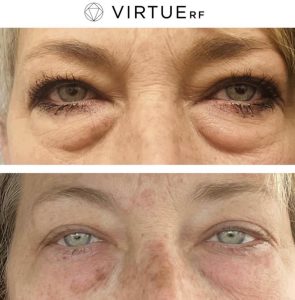 WhatsApp Image 2026-02-11 at 17.37.41 (3)