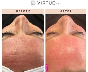 WhatsApp Image 2026-02-11 at 17.37.41