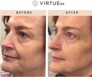 WhatsApp Image 2026-02-11 at 17.37.41 (4)