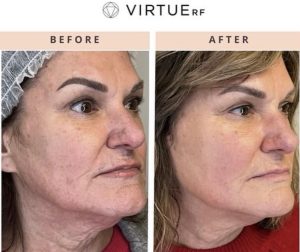 WhatsApp Image 2026-02-11 at 17.37.41 (6)