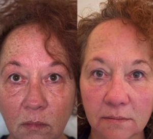 WhatsApp Image 2026-02-11 at 17.37.41 (7)