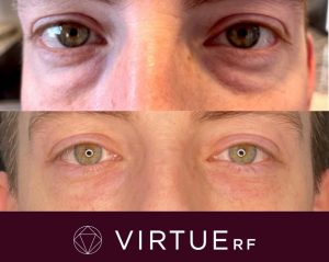 WhatsApp Image 2026-02-11 at 17.37.42 (1)