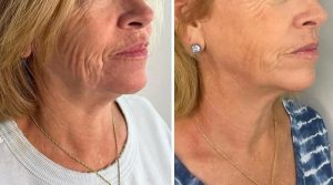 WhatsApp Image 2026-02-11 at 17.37.42